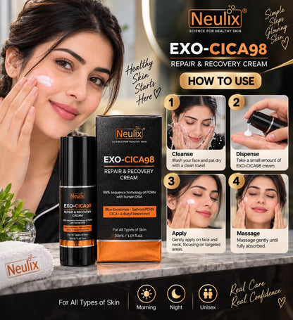 Exo-cica98